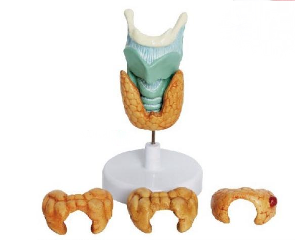 甲狀腺病理模型