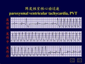 心電圖教學訓練系統(tǒng)