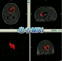 MRI設(shè)備結(jié)構(gòu)虛擬仿真教學(xué)系統(tǒng)